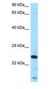 FGF8 Antibody - FGF8 antibody Western Blot of PANC1.  This image was taken for the unconjugated form of this product. Other forms have not been tested.
