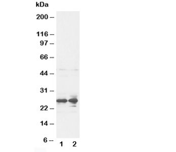 FGF8 Antibody - Western blot testing of FGF8 antibody and rat ovary tissue lysate