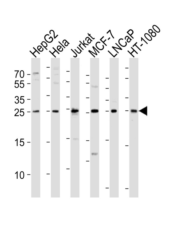FGF8 Antibody - Western blot of lysates from HepG2, HeLa, Jurkat, MCF-7, LNCaP, HT-1080 cell line (from left to right) with FGF8 Antibody. Antibody was diluted at 1:1000 at each lane. A goat anti-rabbit IgG H&L (HRP) at 1:10000 dilution was used as the secondary antibody. Lysates at 20 ug per lane.