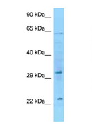 FGF8 Antibody - FGF8 antibody Western blot of HeLa Cell lysate. Antibody concentration 1 ug/ml.  This image was taken for the unconjugated form of this product. Other forms have not been tested.