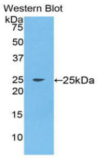 FGF9 Antibody - Western blot of FGF9 antibody with recombinant FGF9.