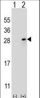 FGF9 Antibody - Western blot of FGF9 (arrow) using rabbit polyclonal FGF9 Antibody. 293 cell lysates (2 ug/lane) either nontransfected (Lane 1) or transiently transfected (Lane 2) with the FGF9 gene.