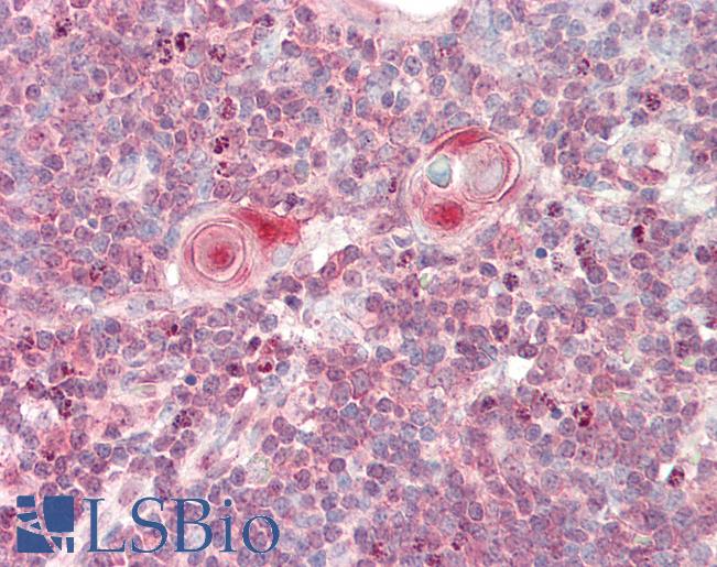 FGF9 Antibody - Human Thymus: Formalin-Fixed, Paraffin-Embedded (FFPE).  This image was taken for the unconjugated form of this product. Other forms have not been tested.