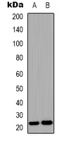 FGF9 Antibody - Western blot analysis of FGF9 expression in HEK293T (A); human brain (B) whole cell lysates.