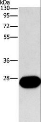 FGF9 Antibody - Western blot analysis of Mouse kidney tissue, using FGF9 Polyclonal Antibody at dilution of 1:800.