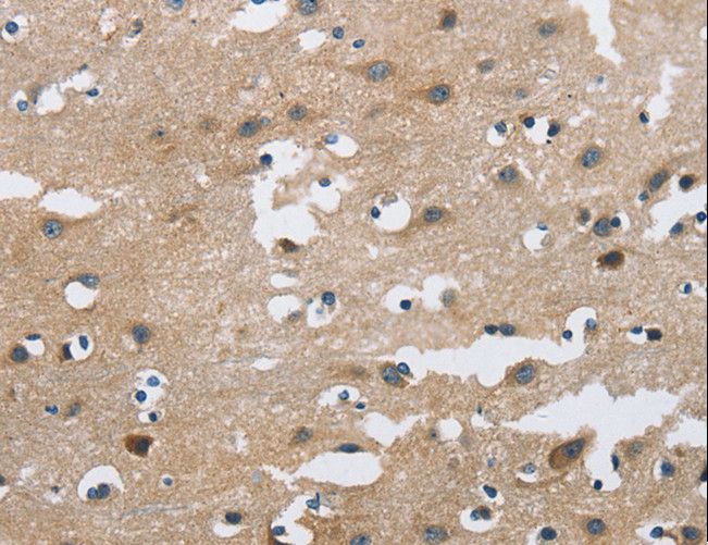 FGF9 Antibody - Immunohistochemistry of paraffin-embedded Human brain using FGF9 Polyclonal Antibody at dilution of 1:40.