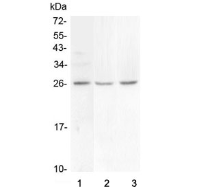 FGF9 Antibody - Western blot testing of 1) human COLO-320, 2) rat brain and 3) mouse brain lysate with FGF9 antibody at 0.5ug/ml. Predicted molecular weight ~23 kDa.