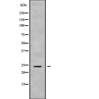 FGF9 Antibody - Western blot analysis FGF9 using Jurkat whole cells lysates