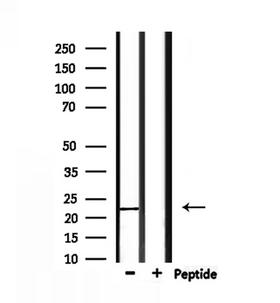FGF9 Antibody - Western blot analysis of extracts of mouse liver tissue using FGF9 antibody.