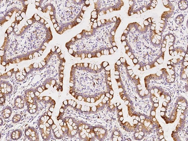 FGF9 Antibody - Immunochemical staining FGF9 in human small intestine with rabbit polyclonal antibody at 1:1000 dilution, formalin-fixed paraffin embedded sections.