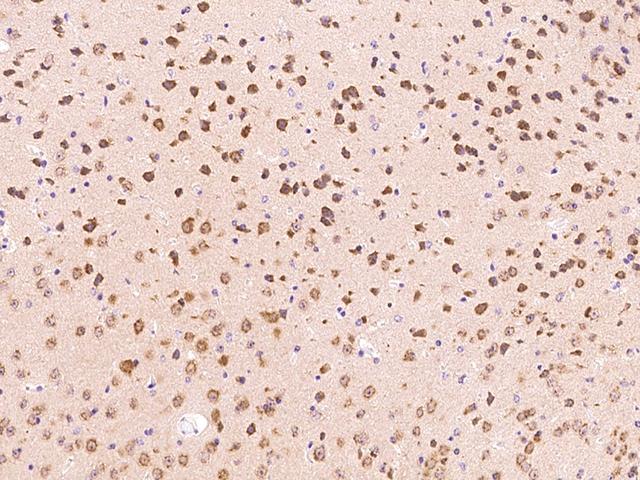FGF9 Antibody - Immunochemical staining FGF9 in mouse brain with rabbit polyclonal antibody at 1:1000 dilution, formalin-fixed paraffin embedded sections.