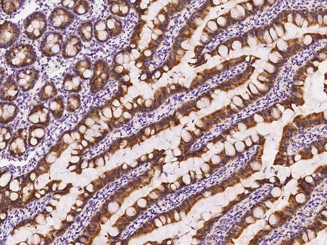 FGF9 Antibody - Immunochemical staining FGF9 in rat small intestine with rabbit polyclonal antibody at 1:1000 dilution, formalin-fixed paraffin embedded sections.