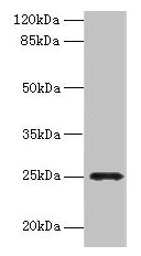 FGFBP2 Antibody - Western blot All lanes: FGFBP2 antibody at 2µg/ml + Human serum Secondary Goat polyclonal to rabbit IgG at 1/10000 dilution Predicted band size: 25 kDa Observed band size: 25 kDa