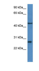 FGFBP2 Antibody - FGFBP2 antibody Western blot of HeLa lysate.  This image was taken for the unconjugated form of this product. Other forms have not been tested.