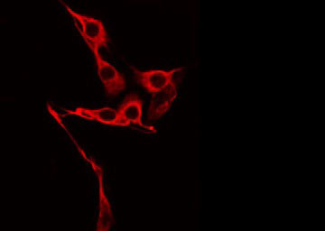 FGFBP2 Antibody - Staining HeLa cells by IF/ICC. The samples were fixed with PFA and permeabilized in 0.1% Triton X-100, then blocked in 10% serum for 45 min at 25°C. The primary antibody was diluted at 1:200 and incubated with the sample for 1 hour at 37°C. An Alexa Fluor 594 conjugated goat anti-rabbit IgG (H+L) Ab, diluted at 1/600, was used as the secondary antibody.