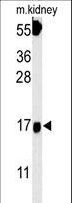 FGFBP3 Antibody - FGFBP3 Antibody western blot of mouse kidney tissue lysates (15 ug/lane). The FGFBP3 antibody detected FGFBP3 protein (arrow).