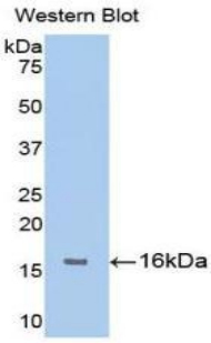 FGFR1 / FGF Receptor 1 Antibody - Western blot of recombinant FGFR1.  This image was taken for the unconjugated form of this product. Other forms have not been tested.
