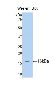 FGFR1 / FGF Receptor 1 Antibody - Western blot of recombinant FGFR1.  This image was taken for the unconjugated form of this product. Other forms have not been tested.
