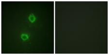 FGFR1 / FGF Receptor 1 Antibody - Immunofluorescence analysis of HUVEC cells, using FGFR1 Antibody. The picture on the right is blocked with the synthesized peptide.