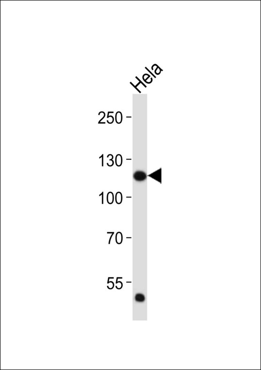 FGFR1 / FGF Receptor 1 Antibody - Western blot of lysate from HeLa cell line, using FGFR1 antibody diluted at 1:2000. A goat anti-mouse IgG H&L (HRP) at 1:3000 dilution was used as the secondary antibody. Lysate at 20 ug.