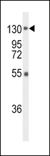 FGFR1 / FGF Receptor 1 Antibody - Western blot of FGFR1 Antibody in mouse liver tissue lysates (35 ug/lane). FGFR1 (arrow) was detected using the purified antibody.