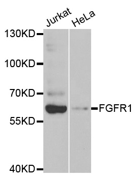 FGFR1 / FGF Receptor 1 Antibody - Western blot analysis of extracts of various cell lines.