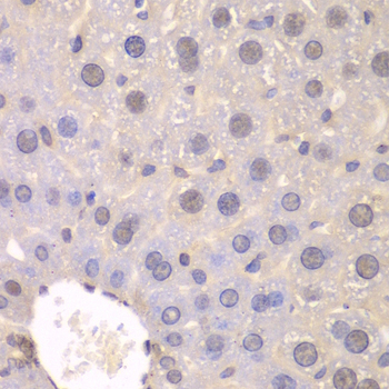 FGFR1 / FGF Receptor 1 Antibody - Immunohistochemistry of paraffin-embedded mouse liver tissue.