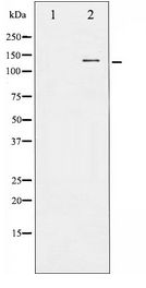 FGFR1 / FGF Receptor 1 Antibody - Western blot of FGFR1 expression in HepG2 whole cell lysates,The lane on the left is treated with the antigen-specific peptide.