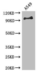 FGFR1 / FGF Receptor 1 Antibody - Positive WB detected in:A549 whole cell lysate;All lanes: Fgfrl1 antibody at 3.4ug/ml;Secondary;Goat polyclonal to rabbit IgG at 1/50000 dilution;Predicted band size: 92,74,7,91,96,83,64,82,56,75,55,17,34 kDa;Observed band size: 92 kDa;