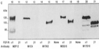 FGFR1 / FGF Receptor 1 Antibody - Detection of a and ß isoforms in recombinant FGFR-1 expressed in Sf9 cells