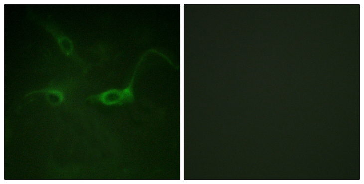 FGFR1 / FGF Receptor 1 Antibody - Immunofluorescence analysis of COS7 cells, using FGFR1 (Phospho-Tyr654) Antibody. The picture on the right is blocked with the phospho peptide.