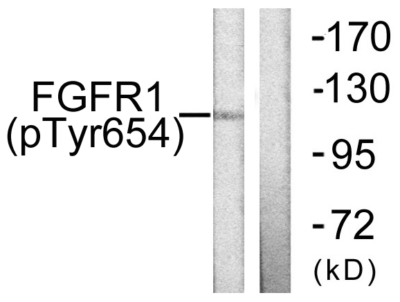FGFR1 / FGF Receptor 1 Antibody - Western blot analysis of lysates from 293 cells treated with Insulin 0.01U/ml 15', using FGFR1 (Phospho-Tyr654) Antibody. The lane on the right is blocked with the phospho peptide.