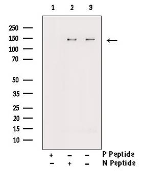 FGFR1 / FGF Receptor 1 Antibody - Western blot analysis of Phospho-FGFR1 (Tyr766) antibody expression in EGF treated HepG2 cells lysates. The lane on the right is treated with the antigen-specific peptide.