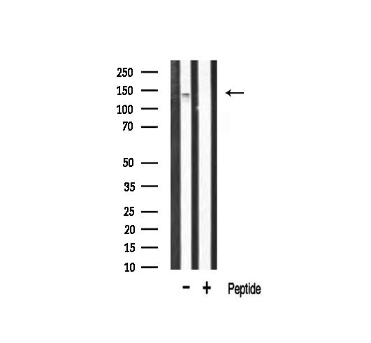 FGFR1 / FGF Receptor 1 Antibody - Western blot analysis of FGFR1 phosphorylation expression in rat kidney tissue lysates. The lane on the right is treated with the antigen-specific peptide.