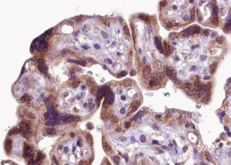 FGFR1 / FGF Receptor 1 Antibody - 1:100 staining human Placenta tissue by IHC-P. The tissue was formaldehyde fixed and a heat mediated antigen retrieval step in citrate buffer was performed. The tissue was then blocked and incubated with the antibody for 1.5 hours at 22°C. An HRP conjugated goat anti-rabbit antibody was used as the secondary.