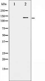 FGFR1 / FGF Receptor 1 Antibody - Western blot analysis of FGFR1 phosphorylation expression in EGF treated HepG2 whole cells lysates. The lane on the left is treated with the antigen-specific peptide.