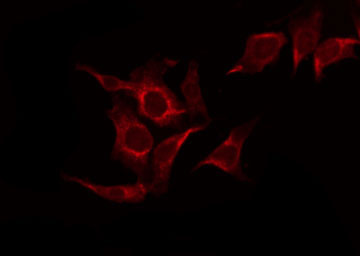 FGFR1 / FGF Receptor 1 Antibody - Staining HepG2 cells by IF/ICC. The samples were fixed with PFA and permeabilized in 0.1% Triton X-100, then blocked in 10% serum for 45 min at 25°C. The primary antibody was diluted at 1:200 and incubated with the sample for 1 hour at 37°C. An Alexa Fluor 594 conjugated goat anti-rabbit IgG (H+L) Ab, diluted at 1/600, was used as the secondary antibody.