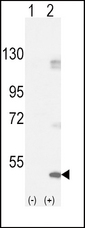 FGFR1 / FGF Receptor 1 Antibody - Western blot of FGFR1 (arrow) using rabbit polyclonal FGFR1-pY154. 293 cell lysates (2 ug/lane) either nontransfected (Lane 1) or transiently transfected with the FGFR1 gene (Lane 2).