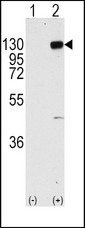 FGFR1 / FGF Receptor 1 Antibody - Western blot of FGFR1 (arrow) using rabbit polyclonal FGFR1 Antibody (Y766) (RB11274). 293 cell lysates (2 ug/lane) either nontransfected (Lane 1) or transiently transfected with the FGFR1 gene (Lane 2) (Origene Technologies).