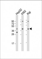 FGFR1OP / FOP Antibody - All lanes: Anti-FGFR1OP Antibody (Center) at 1:1000-1:2000 dilution. Lane 1: HepG2 whole cell lysate. Lane 2: K562 whole cell lysate. Lane 3: Raji whole cell lysate Lysates/proteins at 20 ug per lane. Secondary Goat Anti-Rabbit IgG, (H+L), Peroxidase conjugated at 1:10000 dilution. Predicted band size: 43 kDa. Blocking/Dilution buffer: 5% NFDM/TBST.