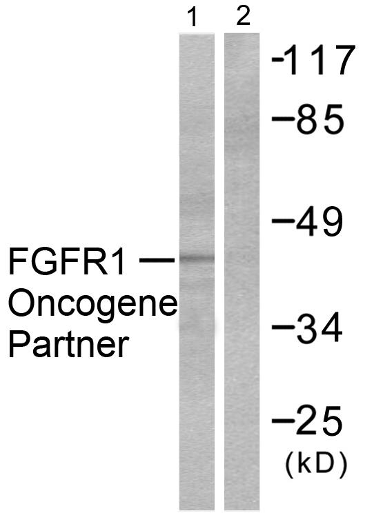 FGFR1OP / FOP Antibody - Western blot analysis of lysates from HepG2 cells, using FGFR1 Oncogene Partner Antibody. The lane on the right is blocked with the synthesized peptide.