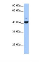 FGFR1OP / FOP Antibody - Placenta lysate. Antibody concentration: 1.0 ug/ml. Gel concentration: 12%.  This image was taken for the unconjugated form of this product. Other forms have not been tested.