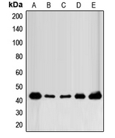 FGFR1OP / FOP Antibody - Western blot analysis of FOP expression in MCF7 (A); MDAMB231 (B); MDAMB435 (C); mouse brain (D); rat brain (E) whole cell lysates.