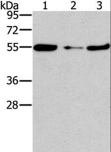 FGFR1OP / FOP Antibody - Western blot analysis of Mouse heart tissue and NIH/3T3 cell, mouse liver tissue, using FGFR1OP Polyclonal Antibody at dilution of 1:850.