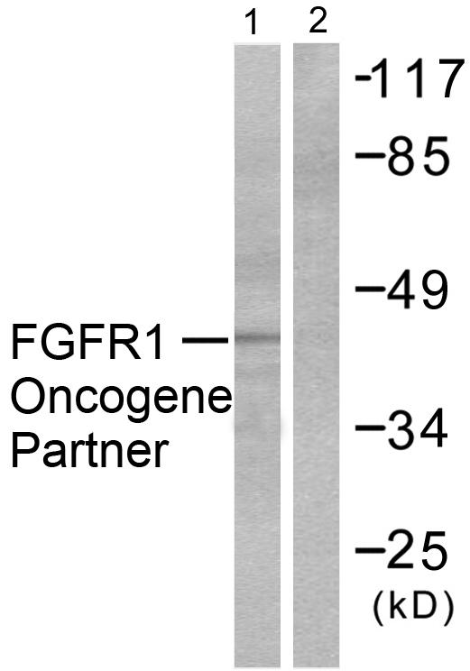 FGFR1OP / FOP Antibody - Western blot analysis of extracts from HepG2 cells, using FGFR1 Oncogene Partner antibody.
