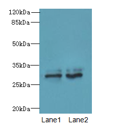FGFR1OP2 Antibody - Western blot. All lanes: FGFR1OP2 antibody at 6 ug/ml. Lane 1: Mouse gonadal tissue. Lane 2: Human placenta tissue. Secondary Goat polyclonal to Rabbit IgG at 1:10000 dilution. Predicted band size: 29 kDa. Observed band size: 29 kDa.