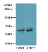 FGFR1OP2 Antibody - Western blot. All lanes: FGFR1OP2 antibody at 6 ug/ml. Lane 1: Mouse gonadal tissue. Lane 2: Human placenta tissue. Secondary Goat polyclonal to Rabbit IgG at 1:10000 dilution. Predicted band size: 29 kDa. Observed band size: 29 kDa.
