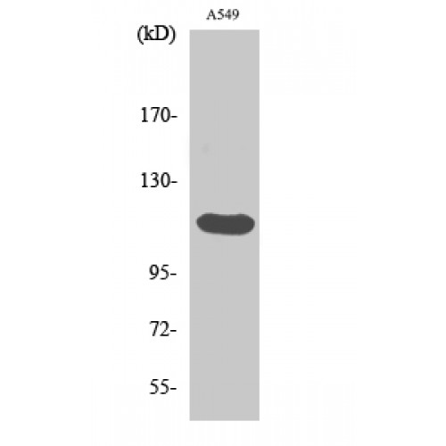 FGFR2 / FGF Receptor 2 Antibody - Western blot of Bek antibody