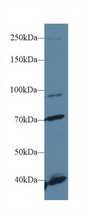 FGFR2 / FGF Receptor 2 Antibody - Western Blot; Sample: Human Hela cell lysate; Primary Ab: 1µg/ml Rabbit Anti-Human FGFR2 Antibody Second Ab: 0.2µg/mL HRP-Linked Caprine Anti-Rabbit IgG Polyclonal Antibody