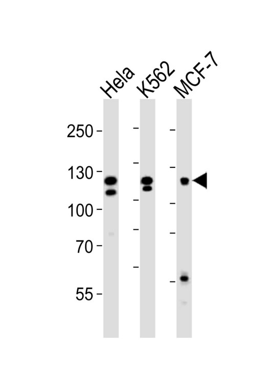 FGFR2 / FGF Receptor 2 Antibody - Western blot of lysates from HeLa, K562, MCF-7 cell line (from left to right), using FGFR2 Antibody R22. Antibody was diluted at 1:1000 at each lane. A goat anti-rabbit IgG H&L (HRP) at 1:10000 dilution was used as the secondary antibody. Lysates at 35ug per lane.